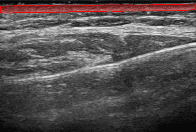 Overview of Dermis Analysis