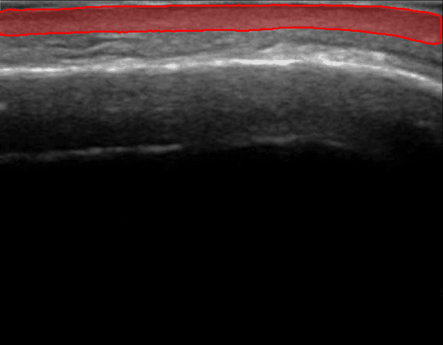 Overview of Dermis Analysis