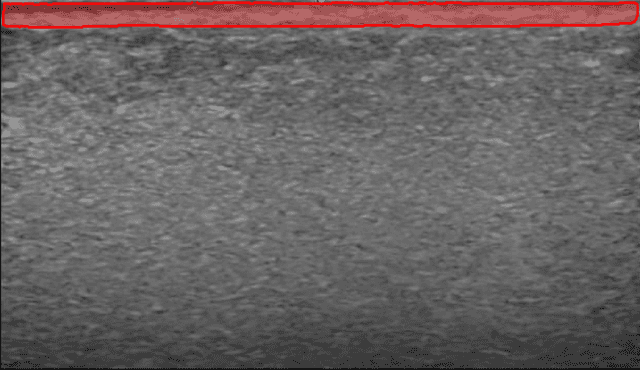 Overview of Dermis Analysis