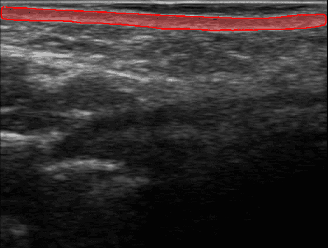 Overview of Dermis Analysis