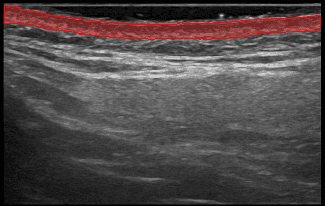 Overview of Dermis Analysis