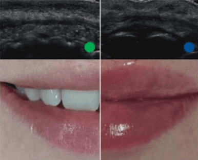 Before and after treatment comparison